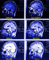 Brain Movies by Harlan Ellison